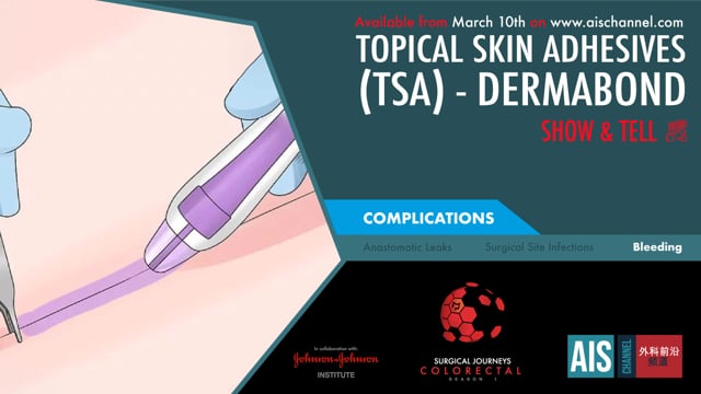 AIS Channel · Topical Skin Adhesives (TSA) - Dermabond